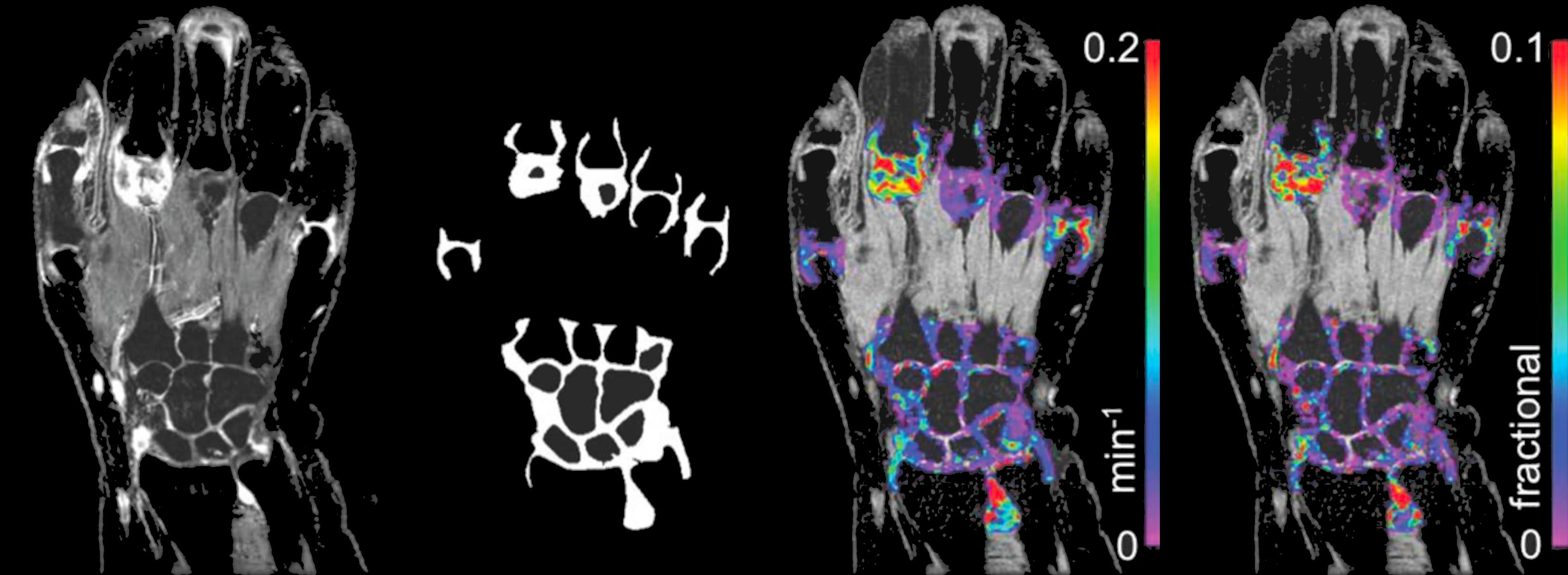 Osteoarthritis imaging
